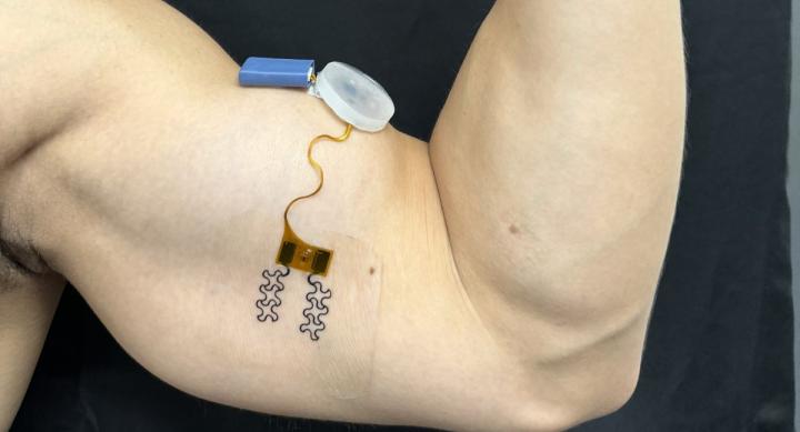 A bicep flexes, wearing a small sensor with a gold node and a blue battery cartridge.