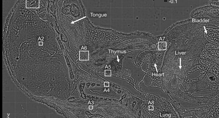 Against a grey background, a microscopic image with different parts of the human body labeled.